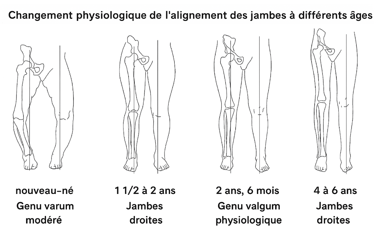 Du berceau aux premiers pas: la place de la chaussure dans le développement du pied du bébé -  - Chausse toi